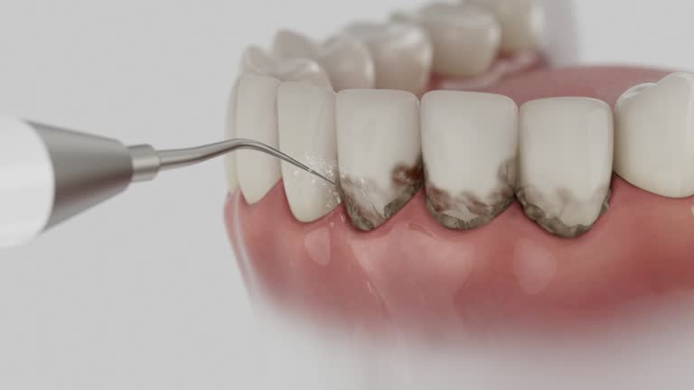 Reliable Dental contractor in Pinehurst, NC by Smile Center Dentistry